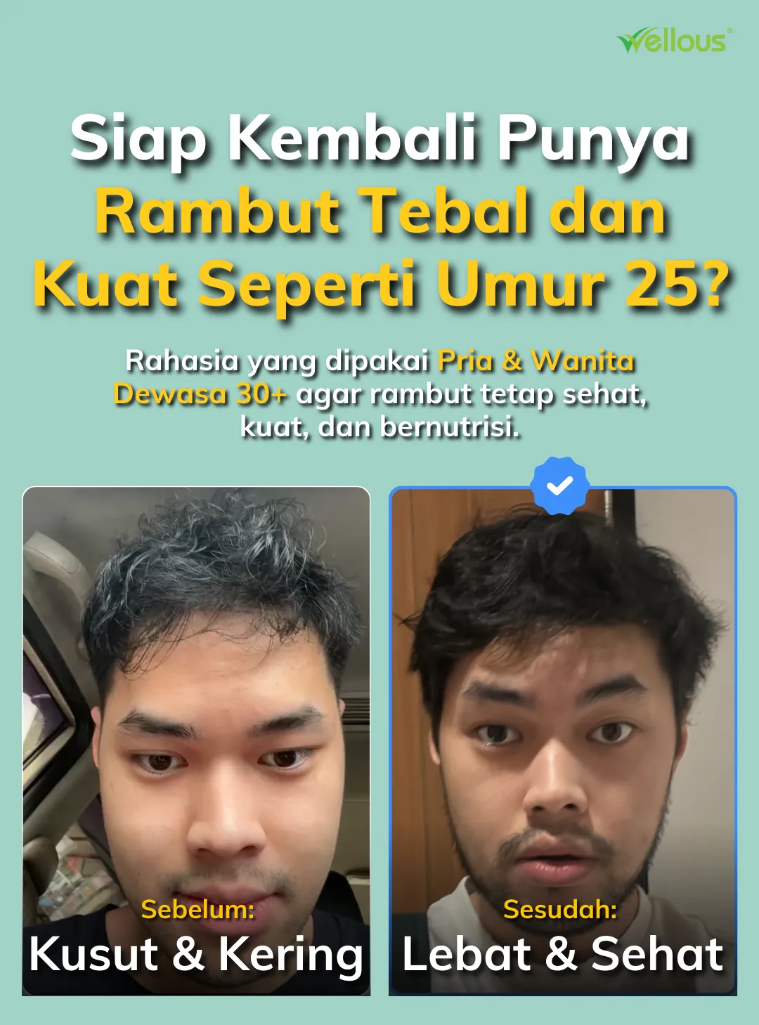 Transformasi rambut — sebelum kusut & kering, sesudah lebat & sehat