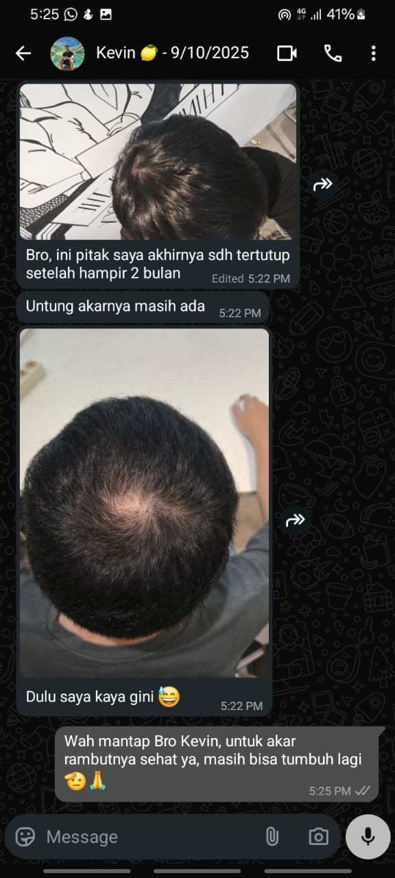 Testimoni Kevin — pitak tertutup setelah 2 bulan